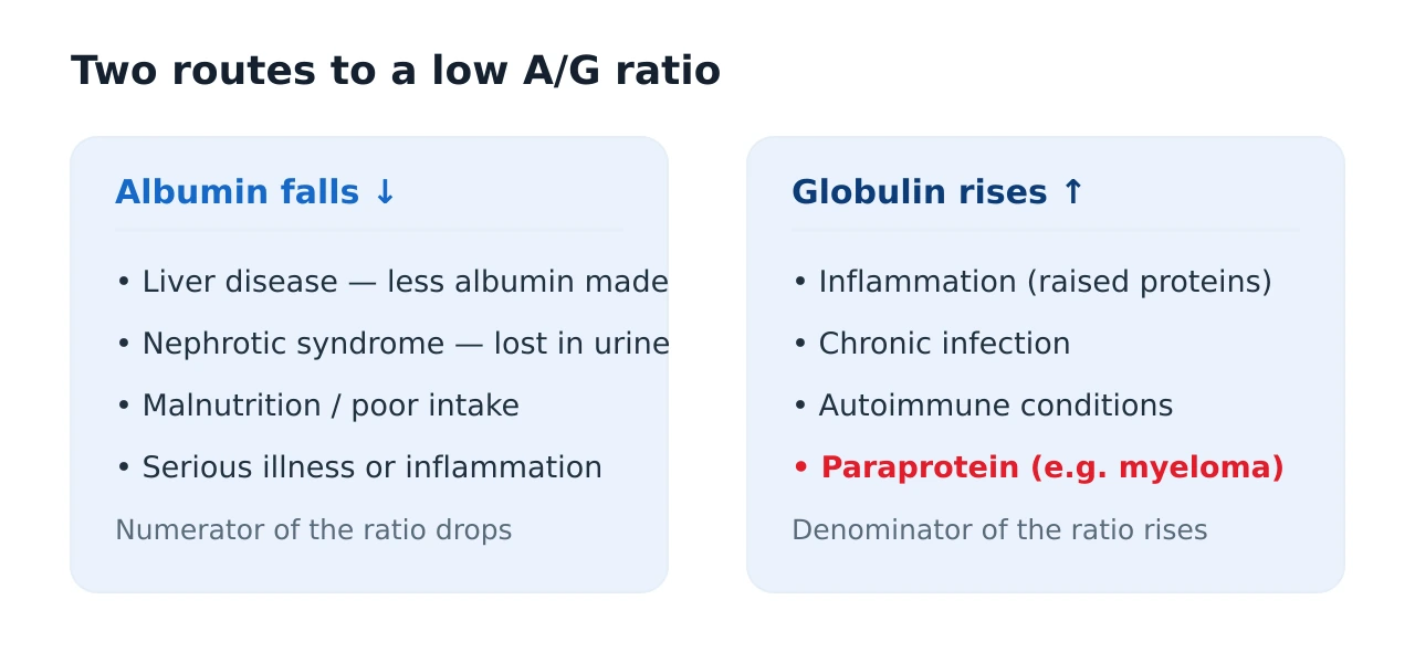 Diagram showing a low A/G ratio caused by either low albumin from liver disease, kidney protein loss or malnutrition, or high globulin from inflammation, infection or a paraprotein