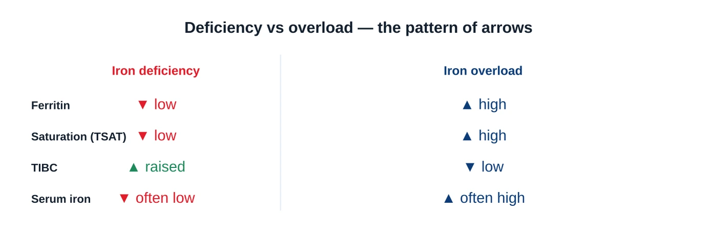Comparison of iron deficiency versus iron overload across ferritin, transferrin saturation, TIBC and serum iron, using up and down arrows