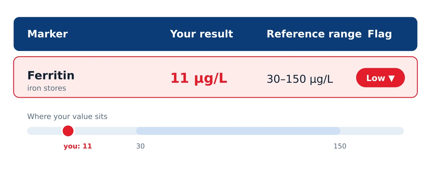 Annotated blood test report row showing the marker name, your result, the reference range and the high or low flag, with a bar placing the value within its range.