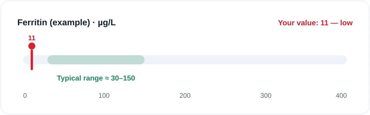 Reference-range bar for ferritin. A green band marks the typical range of about 30 to 150 micrograms per litre; a marker sits low at 11, below the range, illustrating how a value is compared against your report's own range.